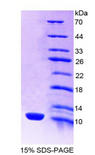 SLC6A3 / Dopamine Transporter Protein - Recombinant  Dopamine Transporter By SDS-PAGE
