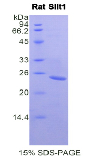 SLIT1 Protein - Recombinant Slit Homolog 1 By SDS-PAGE