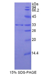 SMMHC / MYH11 Protein - Recombinant Myosin Heavy Chain 11, Smooth Muscle By SDS-PAGE