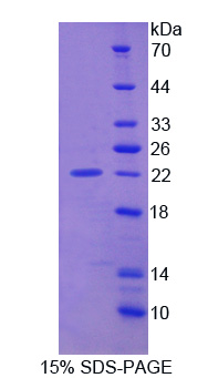 Smoothelin Protein - Recombinant Smoothelin By SDS-PAGE