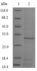 SNCA / Alpha-Synuclein Protein - (Tris-Glycine gel) Discontinuous SDS-PAGE (reduced) with 5% enrichment gel and 15% separation gel.