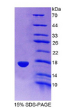 SNCG / Gamma-Synuclein Protein - Recombinant Synuclein Gamma By SDS-PAGE