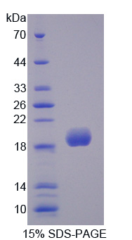 SOD3 Protein - Recombinant Superoxide Dismutase 3, Extracellular By SDS-PAGE
