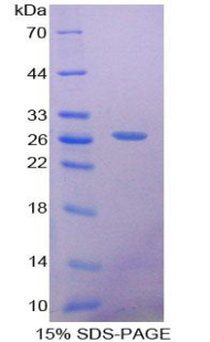 SOX18 Protein - Recombinant Sex Determining Region Y Box Protein 18 By SDS-PAGE