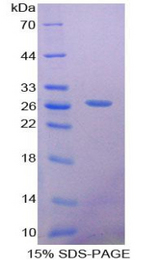 SOX18 Protein - Recombinant Sex Determining Region Y Box Protein 18 By SDS-PAGE