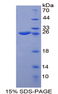 SP100 Protein - Recombinant  Sp100 Nuclear Antigen By SDS-PAGE