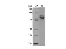 ST6GAL1 / CD75 Protein - Recombinant Rat CD75/ST6GAL1 Protein (His Tag)-Elabscience