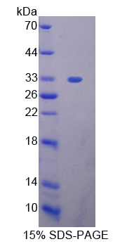STAT2 Protein - Recombinant  Signal Transducer And Activator Of Transcription 2 By SDS-PAGE