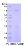 STAT3 Protein - Recombinant Signal Transducer And Activator Of Transcription 3 (STAT3) by SDS-PAGE