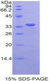 STAT6 Protein - Recombinant Signal Transducer And Activator Of Transcription 6 By SDS-PAGE