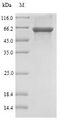 SULT1B1 / Sulfotransferase 1B1 Protein - (Tris-Glycine gel) Discontinuous SDS-PAGE (reduced) with 5% enrichment gel and 15% separation gel.