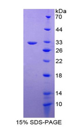 TBX21 / T-bet Protein - Recombinant T-Box Protein 21 By SDS-PAGE