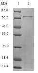 TDO2 Protein - (Tris-Glycine gel) Discontinuous SDS-PAGE (reduced) with 5% enrichment gel and 15% separation gel.