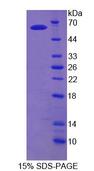 TDP1 Protein - Recombinant Tyrosyl DNA Phosphodiesterase 1 (TDP1) by SDS-PAGE