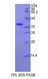 TERT / Telomerase Protein - Recombinant Telomerase Reverse Transcriptase By SDS-PAGE