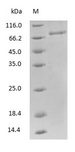 TF / Transferrin Protein - (Tris-Glycine gel) Discontinuous SDS-PAGE (reduced) with 5% enrichment gel and 15% separation gel.