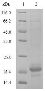 TGFBR2 Protein - (Tris-Glycine gel) Discontinuous SDS-PAGE (reduced) with 5% enrichment gel and 15% separation gel.