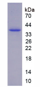 TH / Tyrosine Hydroxylase Protein - Recombinant Tyrosine Hydroxylase By SDS-PAGE