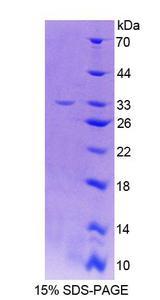 THYN1 / HSPC144 Protein - Recombinant Thymocyte Nuclear Protein 1 By SDS-PAGE