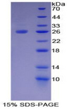TIGIT Protein - Recombinant T-Cell Immunoreceptor With Ig And ITIM Domains Protein By SDS-PAGE