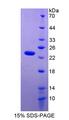 TIMP1 Protein - Recombinant Tissue Inhibitors Of Metalloproteinase 1 By SDS-PAGE