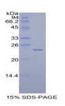 TIMP4 Protein - Recombinant Tissue Inhibitors Of Metalloproteinase 4 By SDS-PAGE