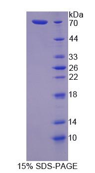 TJP1 / ZO-1 Protein - Recombinant  Tight Junction Protein 1 By SDS-PAGE