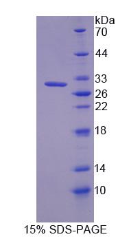 TJP3 / ZO3 Protein - Recombinant Tight Junction Protein 3 (TJP3) by SDS-PAGE