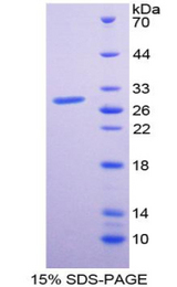 TLR10 Protein - Recombinant Toll Like Receptor 10 By SDS-PAGE
