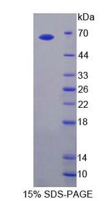 TLR3 Protein - Recombinant Toll Like Receptor 3 (TLR3) by SDS-PAGE