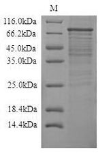 TLR4 Protein - (Tris-Glycine gel) Discontinuous SDS-PAGE (reduced) with 5% enrichment gel and 15% separation gel.