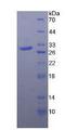 TLR4 Protein - Recombinant Toll Like Receptor 4 By SDS-PAGE