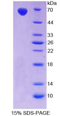 TLR5 Protein - Recombinant  Toll Like Receptor 5 By SDS-PAGE