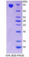 TLR5 Protein - Recombinant  Toll Like Receptor 5 By SDS-PAGE
