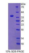 TLR8 Protein - Recombinant  Toll Like Receptor 8 By SDS-PAGE