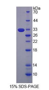 TLR9 Protein - Recombinant  Toll Like Receptor 9 By SDS-PAGE