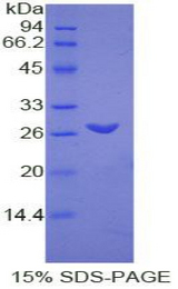 TMEM173 / STING Protein - Recombinant Transmembrane Protein 173 By SDS-PAGE