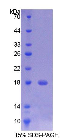TMEM27 / Collectrin Protein - Recombinant  Transmembrane Protein 27 By SDS-PAGE