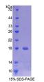 TMEM27 / Collectrin Protein - Recombinant  Transmembrane Protein 27 By SDS-PAGE