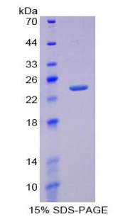 TNFRSF11A / RANK Protein - Recombinant Receptor Activator Of Nuclear Factor Kappa B By SDS-PAGE