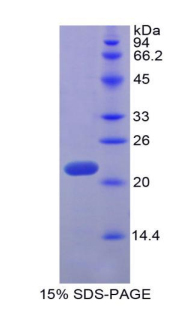 TNFSF14 / LIGHT Protein - Recombinant Tumor Necrosis Factor Ligand Superfamily, Member 14 By SDS-PAGE