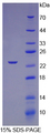 TNNI1 Protein - Recombinant Troponin I Type 1, Slow Skeletal By SDS-PAGE