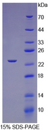 TNNI1 Protein - Recombinant Troponin I Type 1, Slow Skeletal By SDS-PAGE