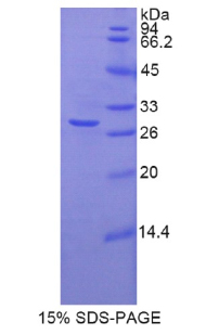 TNNT1 / TNT Protein - Recombinant Troponin T Type 1, Slow Skeletal By SDS-PAGE