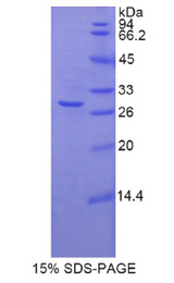 TNNT1 / TNT Protein - Recombinant Troponin T Type 1, Slow Skeletal By SDS-PAGE