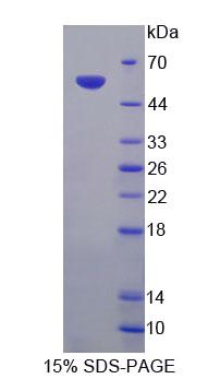 TNR / Tenascin R Protein - Recombinant Tenascin R (TNR) by SDS-PAGE