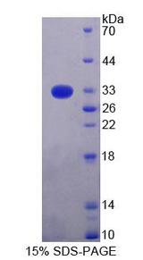 TOP1MT Protein - Recombinant Topoisomerase I, Mitochondrial (TOP1MT) by SDS-PAGE