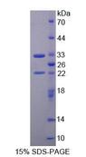 TOPBP1 Protein - Recombinant Topoisomerase II Binding Protein 1 (TOPBP1) by SDS-PAGE