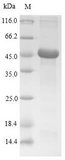 TPSAB1 / Mast Cell Tryptase Protein - (Tris-Glycine gel) Discontinuous SDS-PAGE (reduced) with 5% enrichment gel and 15% separation gel.