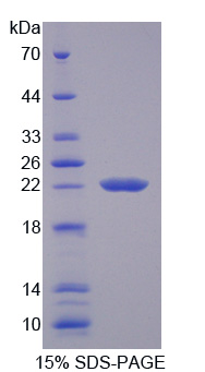 TRPM7 Protein - Recombinant Transient Receptor Potential Cation Channel Subfamily M, Member 7 By SDS-PAGE